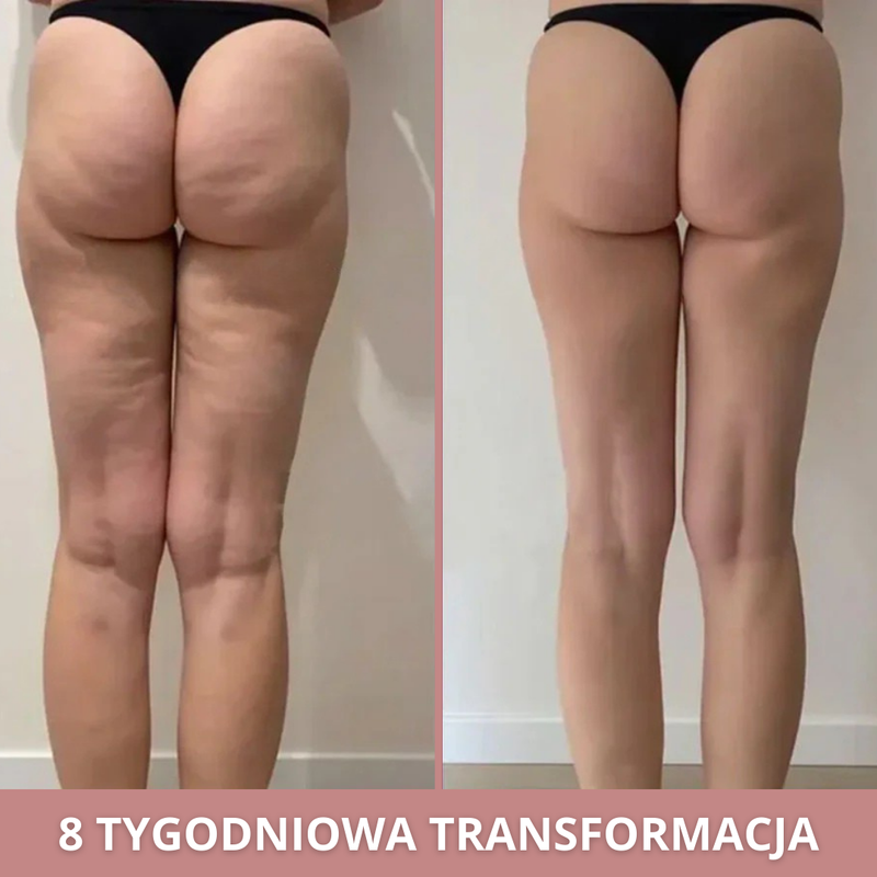 Anna before and after